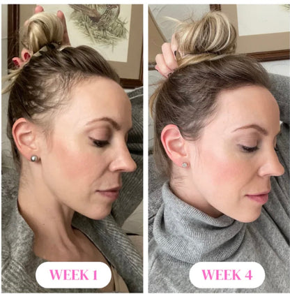 HairVana™ — The Ultimate Hair Growth Brush