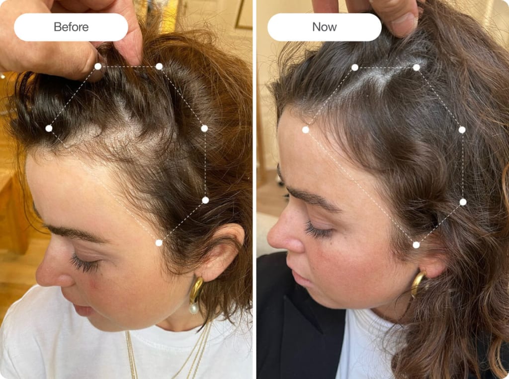 HairVana™ — The Ultimate Hair Growth Brush